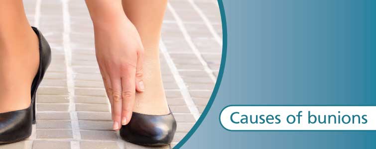 Causes of bunions 