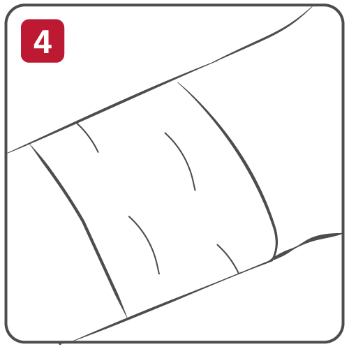 Step 4 Dress the Wound