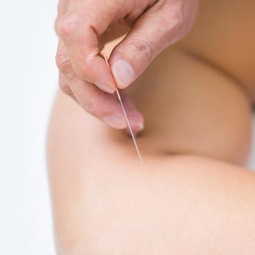 Acupuncture treatment using needle