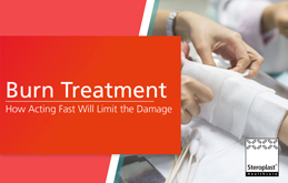 Burn treatment: How acting fast will limit the damage