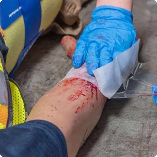 Corius Seal adhesive hydrogel wound dressing
