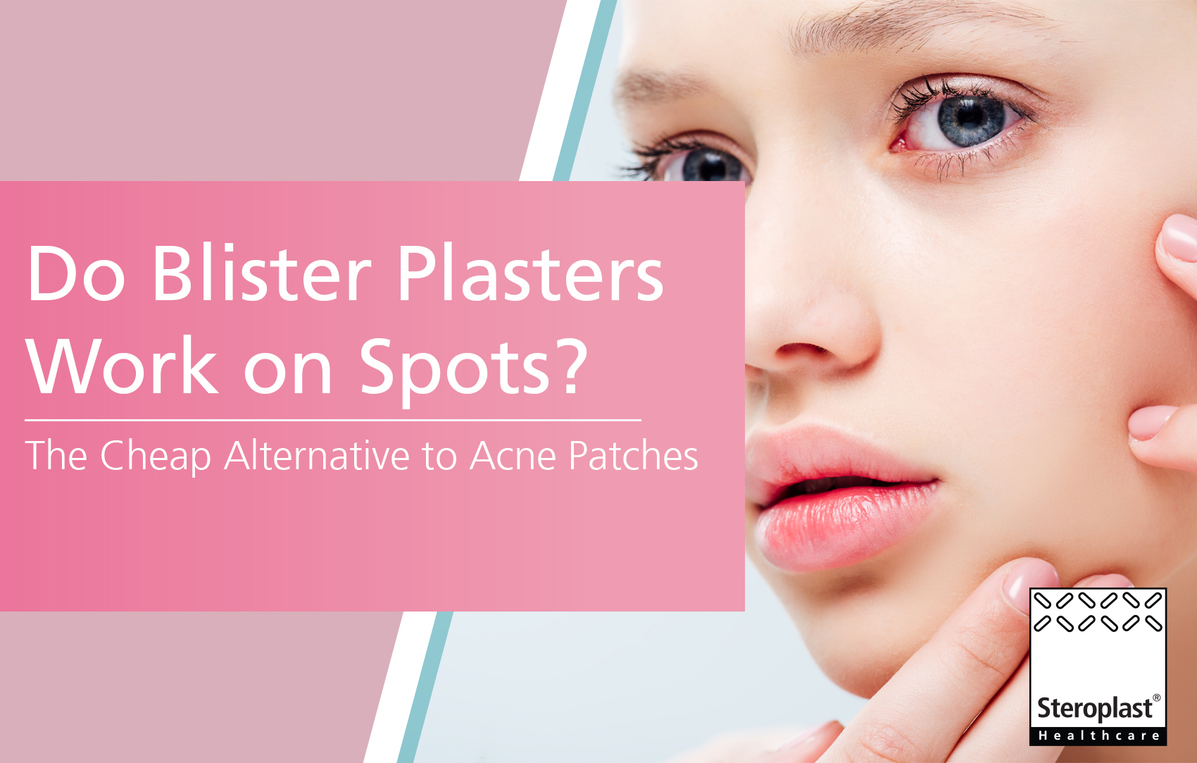 Do Blister Plasters Work on Spots? The Cheap Alternative to Acne Patches