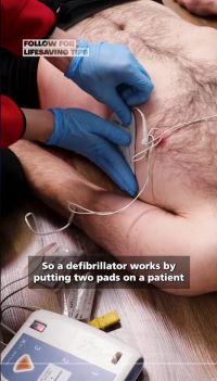 How Does a Defibrillator Work?