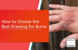 How to Choose the Best Dressing for Burns
