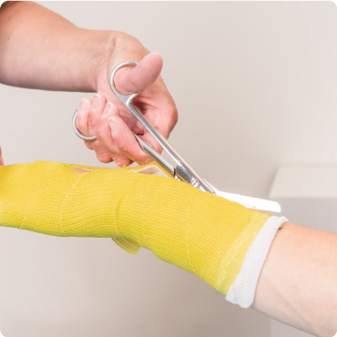Close up of an arm and wrist plaster cast therapy being cut with bandage scissors by a nurse