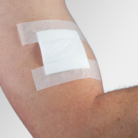 Wound Dressing taped down with microporous tape on someones arm