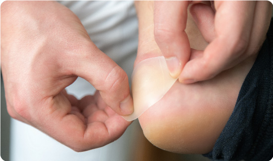 Blister Plaster Being Applied to Foot