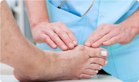 Checking on bunions