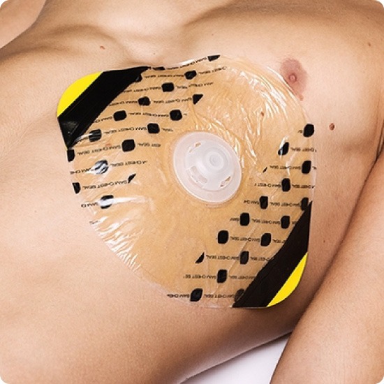 SAM® Chest Seal 2.0 product image