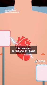 What Does a Defibrillator Do?