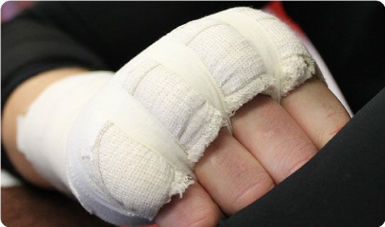 Zinc Oxide tape protecting knuckles