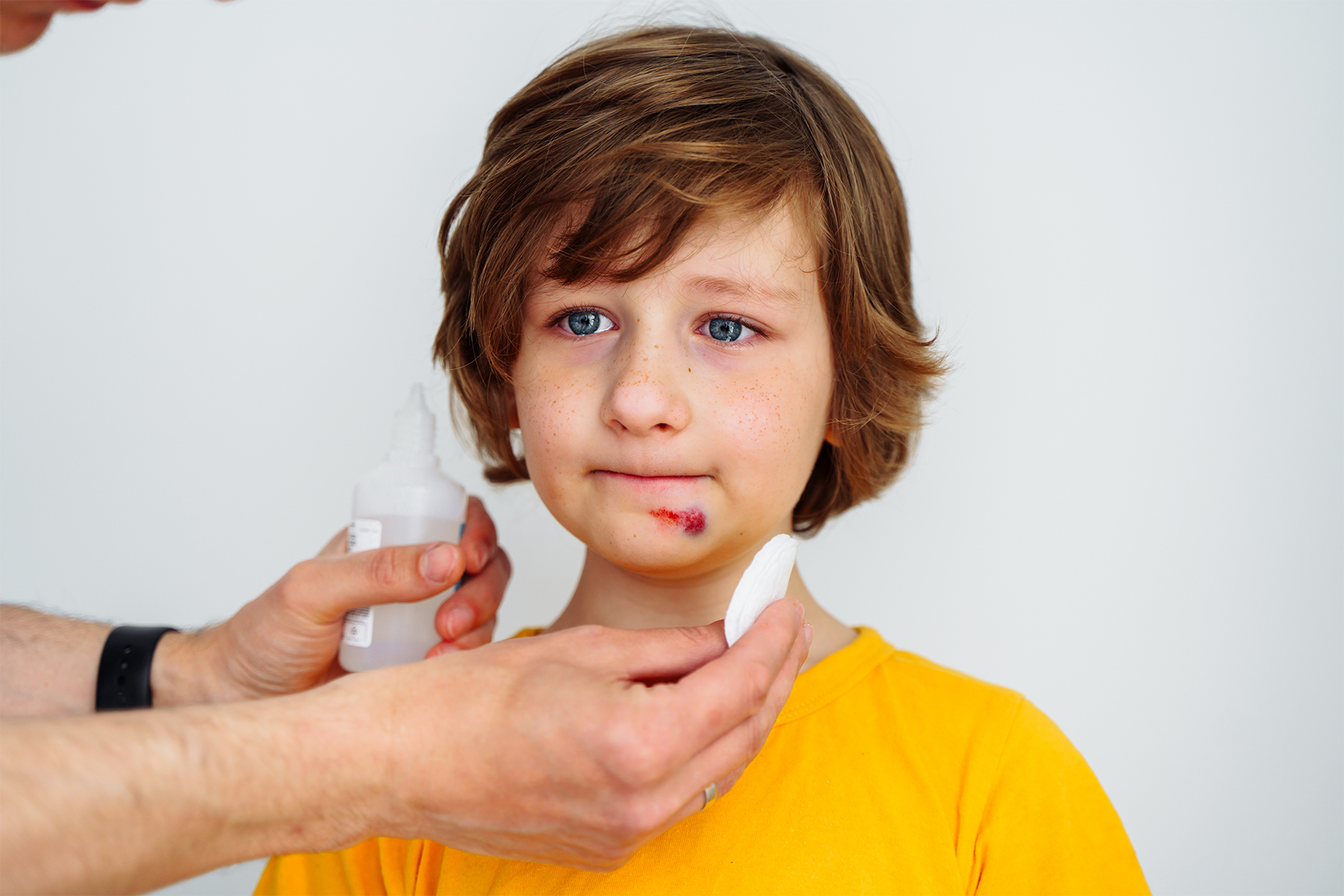 cleaning young boys wound on face